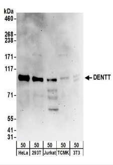 TSPYL2 / DENTT Antibody - Detection of Human DENTT by Western Blot. Samples: Whole cell lysate (50 ug) from HeLa, 293T, Jurkat, mouse TCMK-1, and mouse NIH3T3 cells. Antibodies: Affinity purified rabbit anti-DENTT antibody used for WB at 0.4 ug/ml. Detection: Chemiluminescence with an exposure time of 3 minutes.