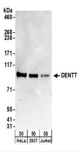 TSPYL2 / DENTT Antibody - Detection of Human DENTT by Western Blot. Samples: Whole cell lysate (50 ug) from HeLa, 293T, Jurkat cells. Antibodies: Affinity purified rabbit anti-DENTT antibody used for WB at 0.4 ug/ml. Detection: Chemiluminescence with an exposure time of 3 minutes.