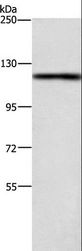 TSPYL2 / DENTT Antibody - Western blot analysis of 231 cell, using TSPYL2 Polyclonal Antibody at dilution of 1:400.