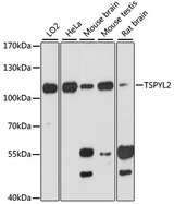 TSPYL2 / DENTT Antibody - Western blot analysis of extracts of various cell lines, using TSPYL2 antibody at 1:3000 dilution. The secondary antibody used was an HRP Goat Anti-Rabbit IgG (H+L) at 1:10000 dilution. Lysates were loaded 25ug per lane and 3% nonfat dry milk in TBST was used for blocking. An ECL Kit was used for detection and the exposure time was 90s.