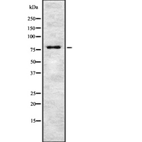 TSPYL2 / DENTT Antibody - Western blot analysis of TSYL2 expression in HEK293 cells. The lane on the left is treated with the antigen-specific peptide.