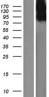 TSPYL2 / DENTT Protein - Western validation with an anti-DDK antibody * L: Control HEK293 lysate R: Over-expression lysate