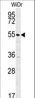 TSPYL4 Antibody - TSPYL4 Antibody western blot of WiDr cell line lysates (35 ug/lane). The TSPYL4 antibody detected the TSPYL4 protein (arrow).