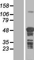 TSPYL4 Protein - Western validation with an anti-DDK antibody * L: Control HEK293 lysate R: Over-expression lysate