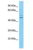 TSPYL5 Antibody - TSPYL5 antibody Western Blot of Jurkat. Antibody dilution: 1 ug/ml.  This image was taken for the unconjugated form of this product. Other forms have not been tested.