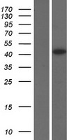 TSPYL5 Protein - Western validation with an anti-DDK antibody * L: Control HEK293 lysate R: Over-expression lysate