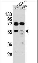 TSPYL6 Antibody - TSPYL6 Antibody western blot of NCI-H460,HeLa cell line lysates (35 ug/lane). The TSPYL6 antibody detected the TSPYL6 protein (arrow).