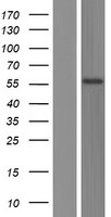 TSPYL6 Protein - Western validation with an anti-DDK antibody * L: Control HEK293 lysate R: Over-expression lysate