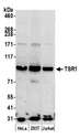 TSR1 Antibody - Detection of human TSR1 by western blot. Samples: Whole cell lysate (50 µg) from HeLa, HEK293T, and Jurkat cells prepared using NETN lysis buffer. Antibody: Affinity purified rabbit anti-TSR1 antibody used for WB at 0.4 µg/ml. Detection: Chemiluminescence with an exposure time of 3 minutes.