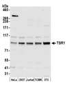 TSR1 Antibody - Detection of human and mouse TSR1 by western blot. Samples: Whole cell lysate (50 µg) from HeLa, HEK293T, Jurkat, mouse TCMK-1, and mouse NIH 3T3 cells prepared using NETN lysis buffer. Antibody: Affinity purified rabbit anti-TSR1 antibody used for WB at 0.4 µg/ml. Detection: Chemiluminescence with an exposure time of 30 seconds.