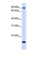 TSR1 Antibody - TSR1 antibody Western blot of Fetal Heart lysate. This image was taken for the unconjugated form of this product. Other forms have not been tested.