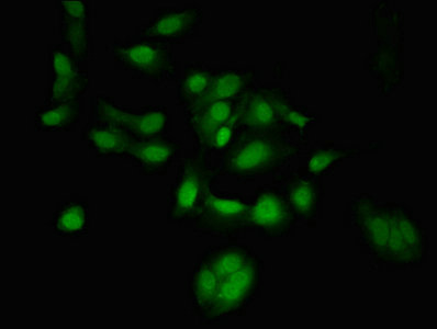 TSR1 Antibody - Immunofluorescent analysis of Hela cells at a dilution of 1:100 and Alexa Fluor 488-congugated AffiniPure Goat Anti-Rabbit IgG(H+L)