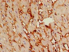 TSR2 Antibody - Immunohistochemistry of paraffin-embedded human heart tissue at dilution of 1:100