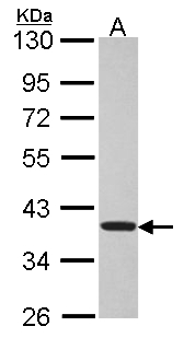 TSSC1 Antibody - Sample (30 ug of whole cell lysate). A: Hela. 10% SDS PAGE. TSSC1 antibody diluted at 1:5000.