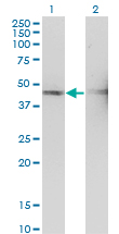 TSSC1 Antibody - Western Blot analysis of TSSC1 expression in transfected 293T cell line by TSSC1 monoclonal antibody (M01), clone 2H5.Lane 1: TSSC1 transfected lysate (Predicted MW: 43.6 KDa).Lane 2: Non-transfected lysate.