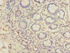 TSSC1 Antibody - Immunohistochemistry of paraffin-embedded human small intestine tissue using antibody at dilution of 1:100.