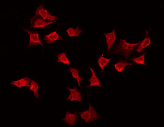 TSSC1 Antibody - Staining HeLa cells by IF/ICC. The samples were fixed with PFA and permeabilized in 0.1% Triton X-100, then blocked in 10% serum for 45 min at 25°C. The primary antibody was diluted at 1:200 and incubated with the sample for 1 hour at 37°C. An Alexa Fluor 594 conjugated goat anti-rabbit IgG (H+L) Ab, diluted at 1/600, was used as the secondary antibody.