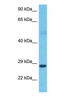 TSSC4 Antibody - Western blot of TSSC4 Antibody with human Lung Tumor lysate.  This image was taken for the unconjugated form of this product. Other forms have not been tested.