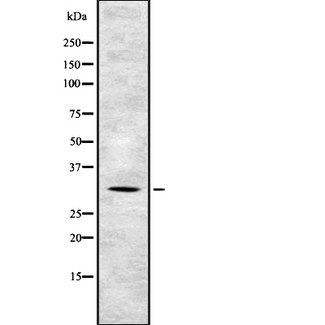 TSSC4 Antibody - Western blot analysis of TSSC4 expression in HEK293 cells. The lane on the left is treated with the antigen-specific peptide.