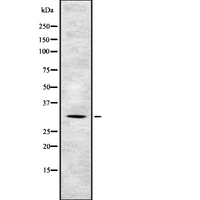 TSSC4 Antibody - Western blot analysis of TSSC4 expression in HEK293 cells. The lane on the left is treated with the antigen-specific peptide.