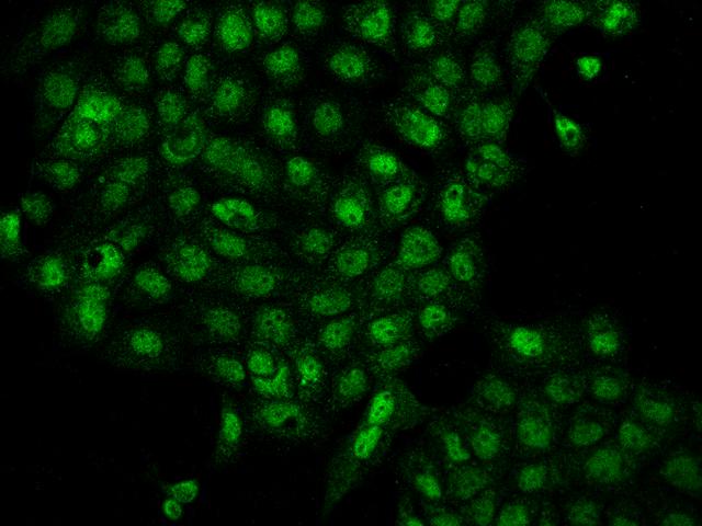 TSSC4 Antibody - Immunofluorescence staining of TSSC4 in A431 cells. Cells were fixed with 4% PFA, permeabilzed with 0.1% Triton X-100 in PBS, blocked with 10% serum, and incubated with rabbit anti-Human TSSC4 polyclonal antibody (dilution ratio 1:200) at 4°C overnight. Then cells were stained with the Alexa Fluor 488-conjugated Goat Anti-rabbit IgG secondary antibody (green). Positive staining was localized to Nucleus.