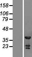 TSSC4 Protein - Western validation with an anti-DDK antibody * L: Control HEK293 lysate R: Over-expression lysate