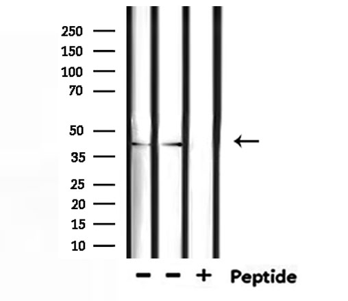 TSSK1B Antibody - Western blot analysis of extracts of mouse liver, mouse lung using TSSK1 antibody.