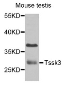 TSSK3 / STK22C Antibody - Western blot analysis of extracts of mouse testis cells.