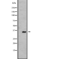 TSSK3 / STK22C Antibody - Western blot analysis of TSSK3 expression in A431 whole cells lysate. The lane on the left is treated with the antigen-specific peptide.