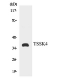 TSSK4 / TSSK5 Antibody - Western blot analysis of the lysates from HT-29 cells using TSSK4 antibody.