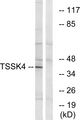 TSSK4 / TSSK5 Antibody - Western blot analysis of lysates from HT-29 cells, using TSSK4 Antibody. The lane on the right is blocked with the synthesized peptide.