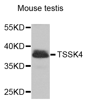 TSSK4 / TSSK5 Antibody - Western blot analysis of extracts of mouse testis.