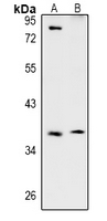 TSSK4 / TSSK5 Antibody - Western blot analysis of TSSK4 expression in mouse testis (A), rat testis (B) whole cell lysates.