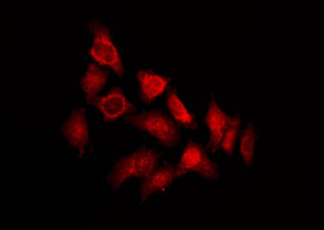 TSSK4 / TSSK5 Antibody - Staining 293T cells by IF/ICC. The samples were fixed with PFA and permeabilized in 0.1% Triton X-100, then blocked in 10% serum for 45 min at 25°C. The primary antibody was diluted at 1:200 and incubated with the sample for 1 hour at 37°C. An Alexa Fluor 594 conjugated goat anti-rabbit IgG (H+L) Ab, diluted at 1/600, was used as the secondary antibody.