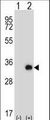 TSSK6 Antibody - Western blot of Tssk6 (arrow) using rabbit polyclonal Mouse Tssk6 Antibody. 293 cell lysates (2 ug/lane) either nontransfected (Lane 1) or transiently transfected (Lane 2) with the Tssk6 gene.