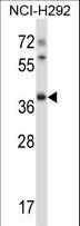TSSK6 Antibody - Mouse Tssk6 Antibody western blot of NCI-H292 cell line lysates (35 ug/lane). The Tssk6 antibody detected the Tssk6 protein (arrow).