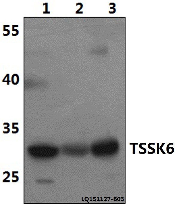 TSSK6 Antibody - Western blot of TSSK6 polyclonal antibody at 1:500 dilution. Lane 1: HeLa whole cell lysate (40 ug). Lane 2: The Testis tissue lysate of Rat(40 ug). Lane 3: The Testis tissue lysate of Mouse(40 ug).