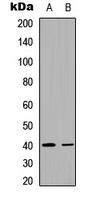 TSTA3 /  GDP-L-Fucose Synthase Antibody - Western blot analysis of FX expression in HeLa (A); rat muscle (B) whole cell lysates.
