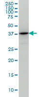 TSTA3 /  GDP-L-Fucose Synthase Antibody - TSTA3 monoclonal antibody (M01), clone 2B9 Western Blot analysis of TSTA3 expression in HeLa.