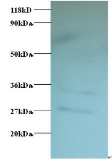 TSTA3 /  GDP-L-Fucose Synthase Antibody - Western blot of GDP-L-fucose synthase Antibody at 2 ug/ml + EC109 whole cell lysate at 20 ug/ml. Secondary: Goat polyclonal to Rabbit IgG at 1:15000 dilution. Predicted band size:35 kDa. Observed band size:35 kDa. Additional bands at:27 kDa. We are unsure as to the identity of this extra band.  This image was taken for the unconjugated form of this product. Other forms have not been tested.