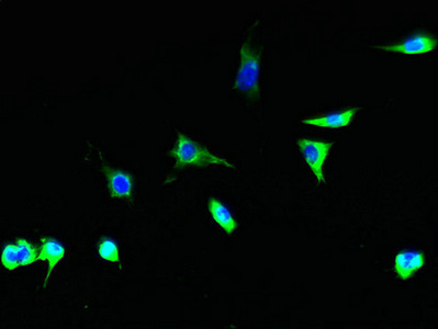 TSTA3 /  GDP-L-Fucose Synthase Antibody - Immunofluorescent analysis of Hela cells using TSTA3 Antibody at dilution of 1:100 and Alexa Fluor 488-congugated AffiniPure Goat Anti-Rabbit IgG(H+L)