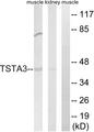 TSTA3 /  GDP-L-Fucose Synthase Antibody - Western blot analysis of extracts from rat kidney cells and rat muscle cells, using TSTA3 antibody.