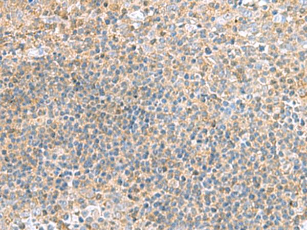 TSTA3 /  GDP-L-Fucose Synthase Antibody - Immunohistochemistry of paraffin-embedded Human tonsil tissue  using TSTA3 Polyclonal Antibody at dilution of 1:45(×200)