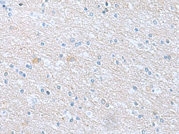 TSTA3 /  GDP-L-Fucose Synthase Antibody - Immunohistochemistry of paraffin-embedded Human brain tissue  using TSTA3 Polyclonal Antibody at dilution of 1:45(×200)