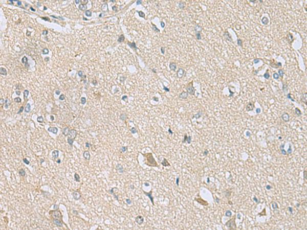 TSTA3 /  GDP-L-Fucose Synthase Antibody - Immunohistochemistry of paraffin-embedded Human brain tissue  using TSTA3 Polyclonal Antibody at dilution of 1:80(×200)
