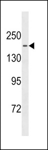 TTBK1 Antibody - TTBK1 Antibody western blot of HepG2 cell line lysates (35 ug/lane). The TTBK1 antibody detected the TTBK1 protein (arrow).