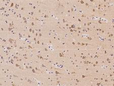 TTBK1 Antibody - Immunochemical staining of human TTBK1 in human brain with rabbit polyclonal antibody at 1:100 dilution, formalin-fixed paraffin embedded sections.