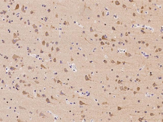 TTBK1 Antibody - Immunochemical staining of human TTBK1 in human brain with rabbit polyclonal antibody at 1:100 dilution, formalin-fixed paraffin embedded sections.
