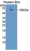 TTBK2 Antibody - Western blot of TTBK2 antibody.