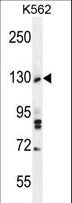 TTBK2 Antibody - TTBK2 Antibody western blot of K562 cell line lysates (35 ug/lane). The TTBK2 antibody detected the TTBK2 protein (arrow).